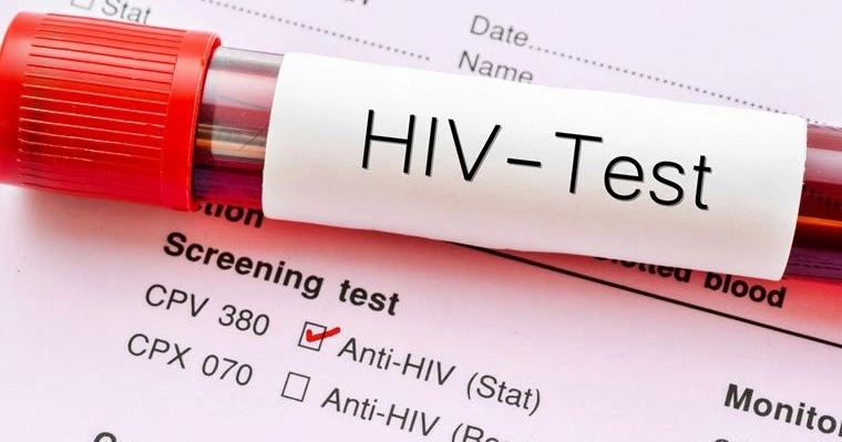 Srpska bilježi nagli skok broja zaraženih HIV-om