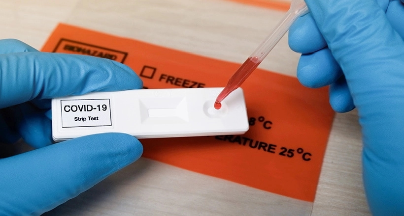 U Srpskoj 18 preminulih, zaražene još 223 оsоbе