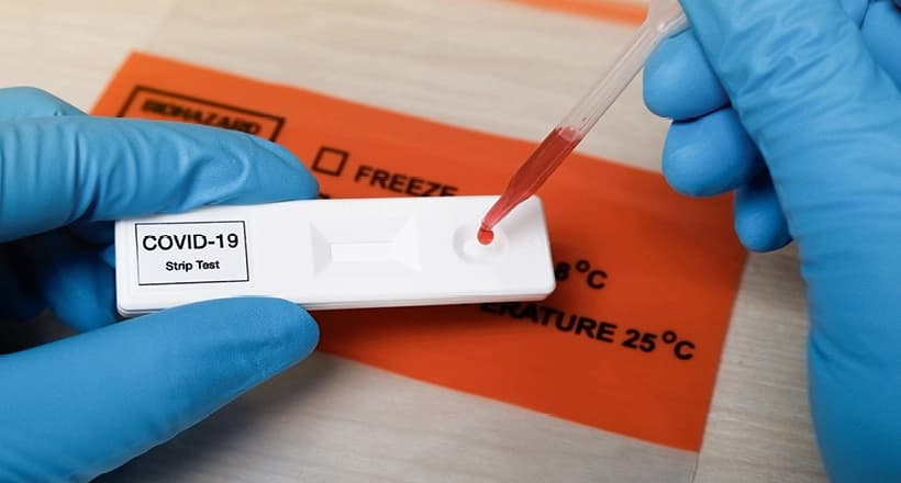 U Srpskoj preminulo osam osoba, koronom zaraženo još 257